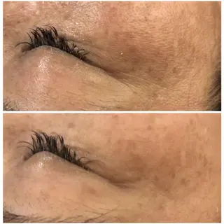 夏までに肌荒れ卒業 するサロン🌻のエステ・リラクイメージ