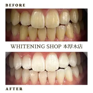 メンズ ホワイトニング ショップ本厚木のその他イメージ