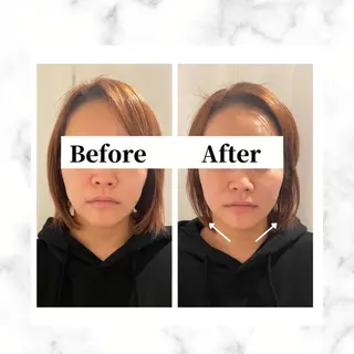 12Dハイフ💗 最強小顔のエステ・リラクイメージ