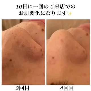 Bellesthe （ベルエステ）のエステ・リラクイメージ