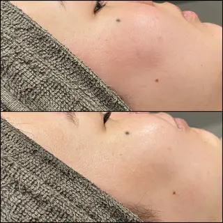 LiZA エステティックサロンのその他イメージ