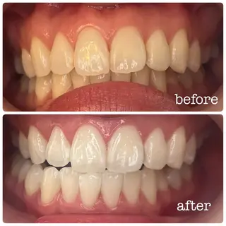 DH. MISATOの眉毛・アイブロウイメージ