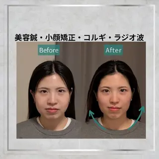 KANWA鍼灸院所属・KANWA 鍼灸院のエステ・リラクイメージ