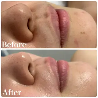 LAKI eye&face  studio所属・LAKI studioのエステ・リラクイメージ