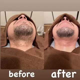 メンズ眉毛ITSUK Iメンズ専門　新宿の眉毛・アイブロウイメージ