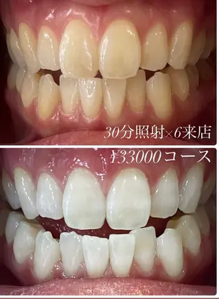 ホワイトニングルーム　川崎店所属・ホワイトニング ルーム　川崎店のその他イメージ