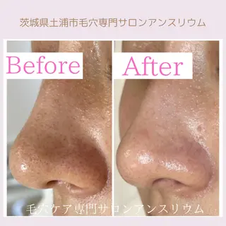 毛穴ケア専門サロンアンスリウム所属・茨城土浦 つくば毛穴 ケア専門サロンのエステ・リラクイメージ