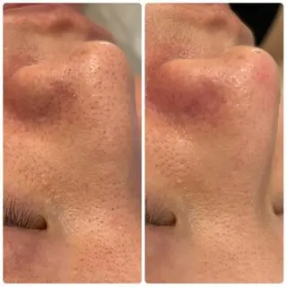 ✨美肌水光✨ アトリエリュバンのエステ・リラクイメージ