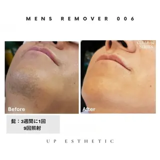 メンズ ウプエステティック所属・韓国肌管理 ウプエステティックのエステ・リラクイメージ