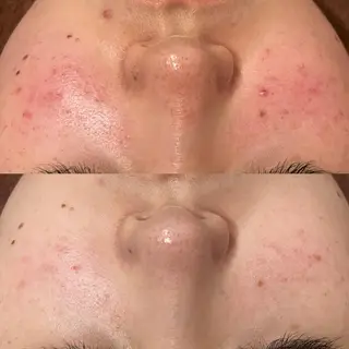 触れたくなる モテ肌へ...❤︎のエステ・リラクイメージ