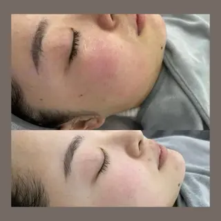 愛維美水光美肌専門店所属・愛維美水光美肌専門店 メンズレディースokのエステ・リラクイメージ