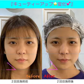 小顔美肌&痩身ｻﾛﾝ My Timeのエステ・リラクイメージ