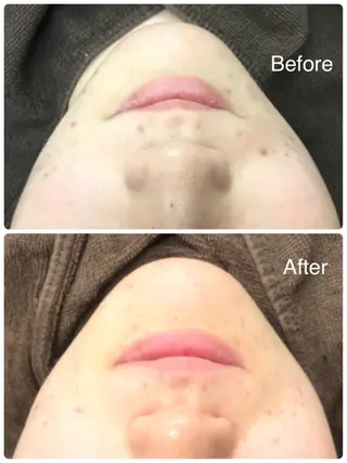 肌質改善サロン La Divinaのエステ・リラクイメージ