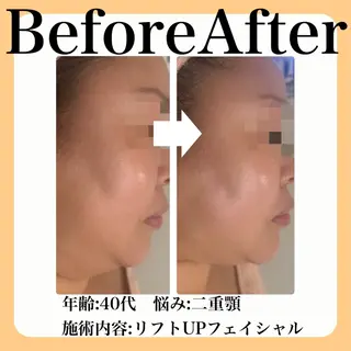 毛穴・たるみ･ニキビケア専門サロンsui所属・sui【スイ】 ARISAのエステ・リラクイメージ