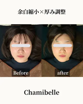 美容鍼灸サロン Chamibelleのエステ・リラクイメージ
