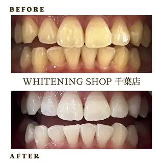 メンズ ホワイトニング ショップ千葉店のその他イメージ