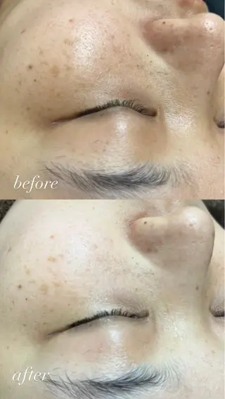 smile nail スマイルネイルのその他イメージ