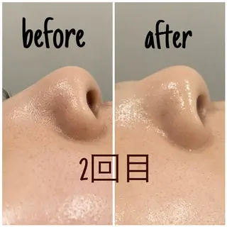 毛穴洗浄・痩身・脱毛 /アルカンジュのエステ・リラクイメージ