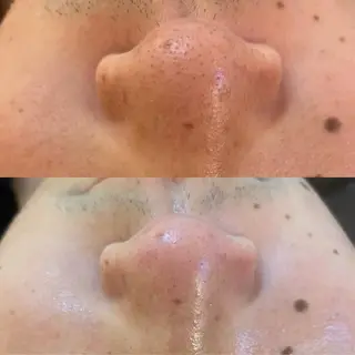 BELCIA福岡店　récolte de BELCIA（レコルトデベルシア）所属・BELCIA福岡店 レコルトデベルシアのエステ・リラクイメージ