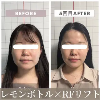 小顔矯正専門店 【RED】池田のエステ・リラクイメージ