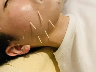 むくみたるみ専門☆ 美容鍼・小顔矯正のエステ・リラクイメージ