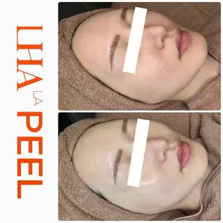 ハーブピーリング専門 BIOEL横浜のエステ・リラクイメージ