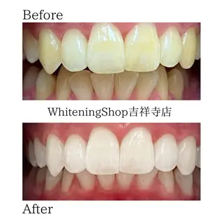 ホワイトニング ショップ吉祥寺店のエステ・リラクイメージ