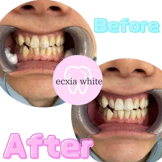 ecxia  white 　広島袋町店所属・セルフホワイトニング エクシア広島袋町店のその他イメージ