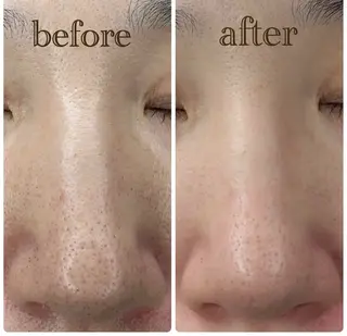 POLA THE BEAUTY 堺東店所属・肌管理🌿毛穴改善 POLA堺東のエステ・リラクイメージ