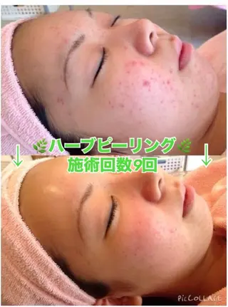 脱毛&美容サロン Dr.Epiのエステ・リラクイメージ