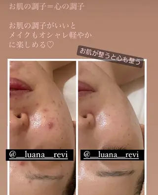 Luana ∞のエステ・リラクイメージ