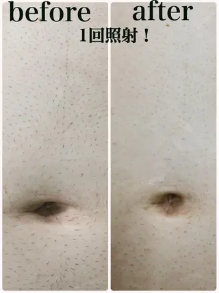 メンズ 外山 理都子のエステ・リラクイメージ