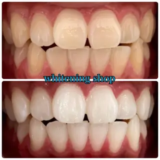 メンズ ホワイトニング ショップ川越店のエステ・リラクイメージ