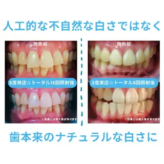 ホワイトニングサロン ネージュ(女性専用)のその他イメージ