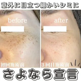 最新シミケアLily de pearlのエステ・リラクイメージ