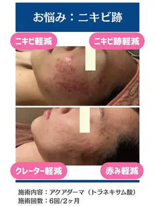 毛穴レス美肌へ🌿 看護師Abe🌼のエステ・リラクイメージ