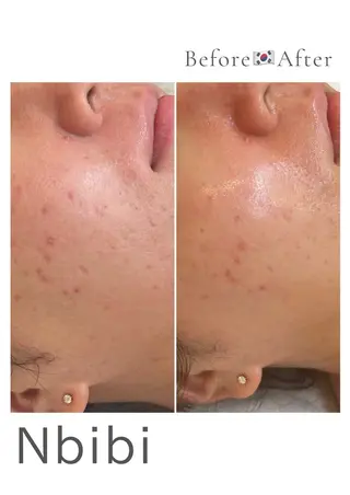 韓国🇰🇷価格 サロン_Nbibiのエステ・リラクイメージ