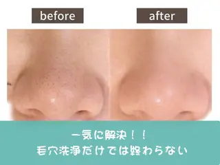 COCO  MIELE所属・毛穴・肌管理サロン COCO MIELEのその他イメージ