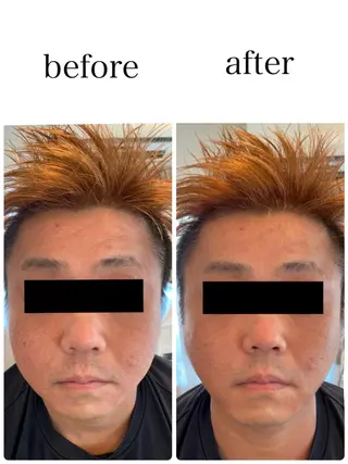 姿勢改善&beauty salon LAUB所属・姿勢改善 サロンLAUB奥村のエステ・リラクイメージ