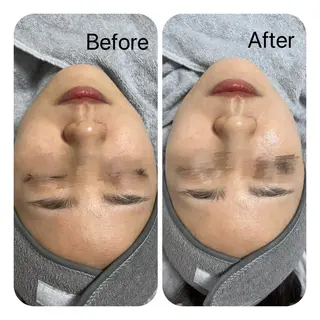 Éclat de Belle🫧白玉肌のエステ・リラクイメージ