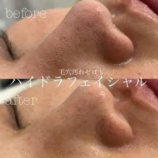 フェイシャルサロン CHIARA 荒田のエステ・リラクイメージ