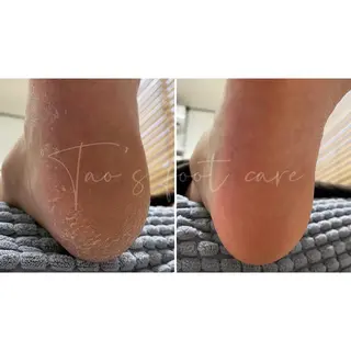 Sugaring / HILOT TAOのエステ・リラクイメージ