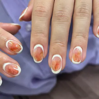 ネイル MAHINA nail所属・MAHINA/ネイル 巻き爪矯正/角質ケアのネイルデザイン