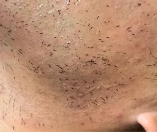 メンズ aNahata beauty salon所属・田中 菜月のエステ・リラクイメージ