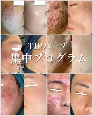 Ellebeauty relaxationのエステ・リラクイメージ