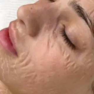 小顔・美肌ケア専門 Diva北浜のエステ・リラクイメージ