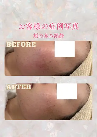 pansy(パンジー)上野フェイシャルエステ専門店所属・pansy saraのエステ・リラクイメージ