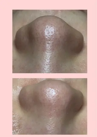 beauty salon N.11所属・beauty salonN.11のエステ・リラクイメージ