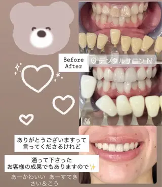 デンタルサロンN～セルフホワイトニング・オーラルケア～所属・デンタルサロンN 和光市駅徒歩3分のその他イメージ