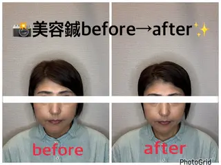 小林整骨院本町 美容鍼roomのエステ・リラクイメージ